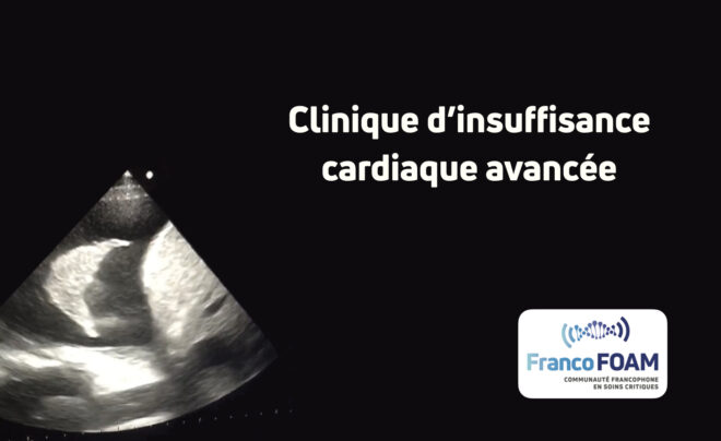 Épisode 51 Clinique d’insuffisance cardiaque avancée